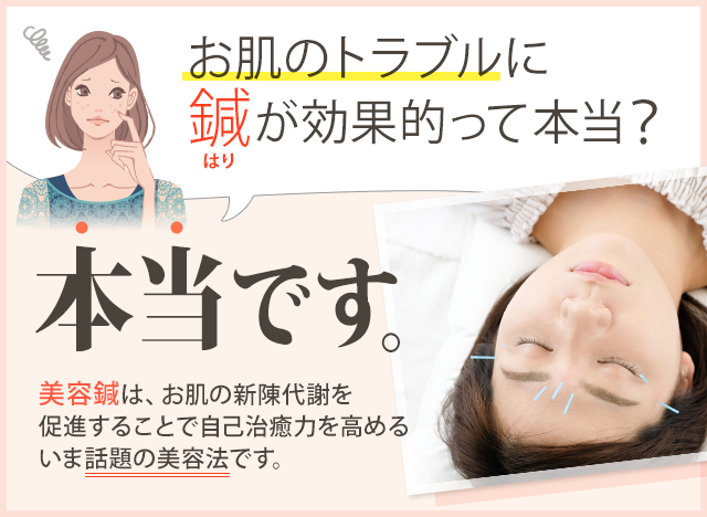 鍼（はり）がお肌のトラブルに良いって聞いたけど、 本当なんですか？はい、本当です！ 肌の新陳代謝が盛んになり、自分で治そうとする力が高まるからです。