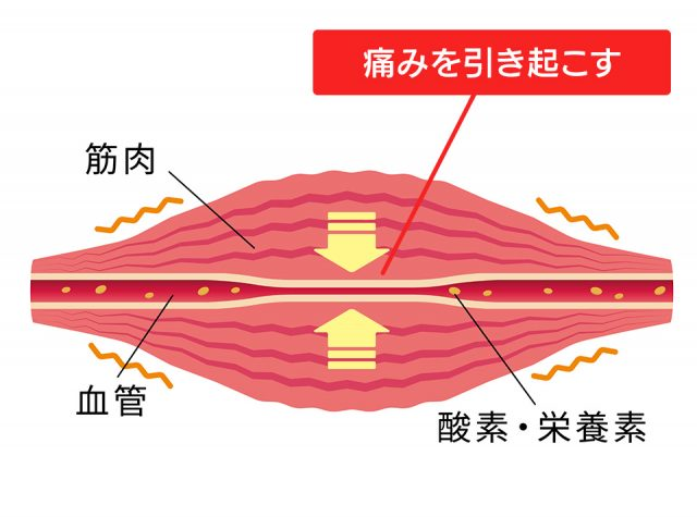 痛みを引き起こす原因